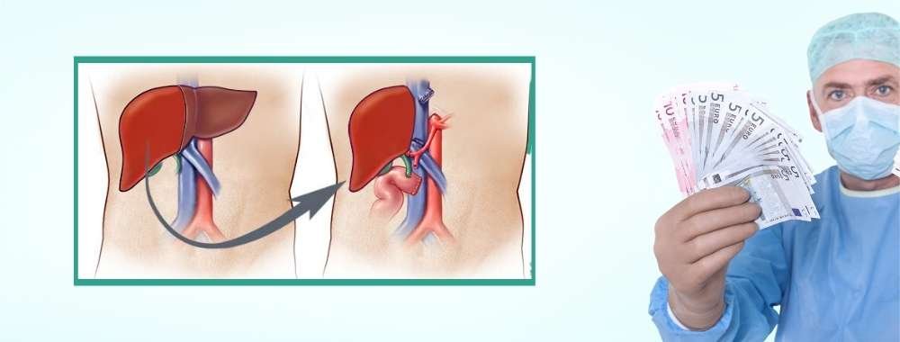 factors that affect the cost of liver transplant surgery in india