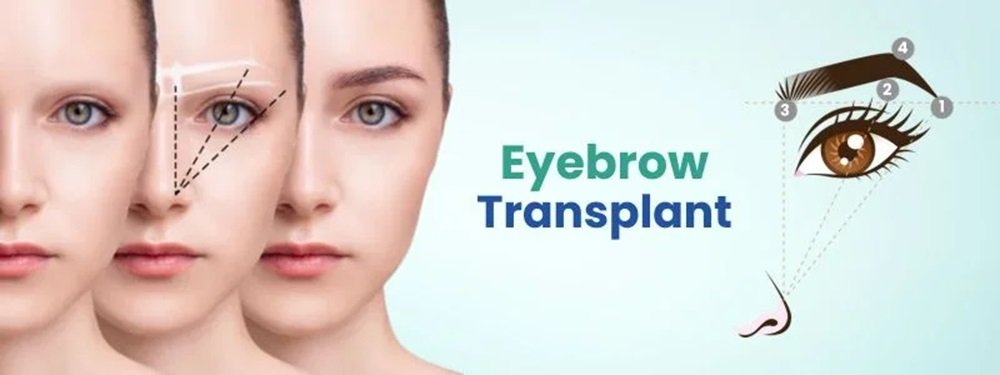 eyebrow transplant cost in india