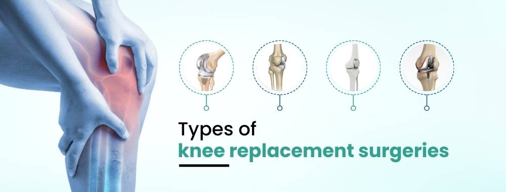 types of knee replacement surgeries