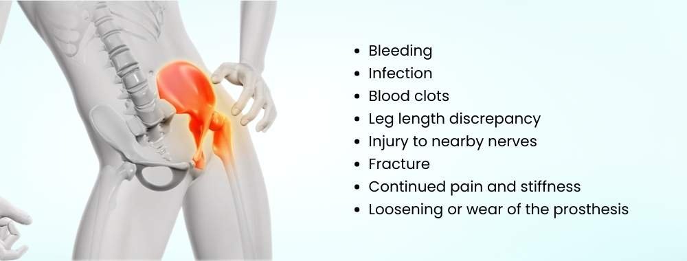 possible complications of hip replacement surgery