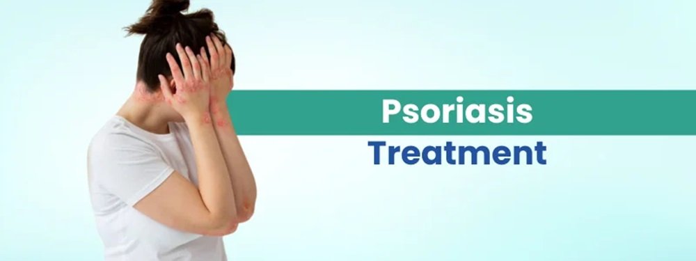 psoriasis treatment cost in india