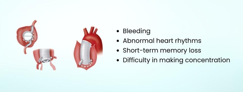 risks and complications management in bentall procedure