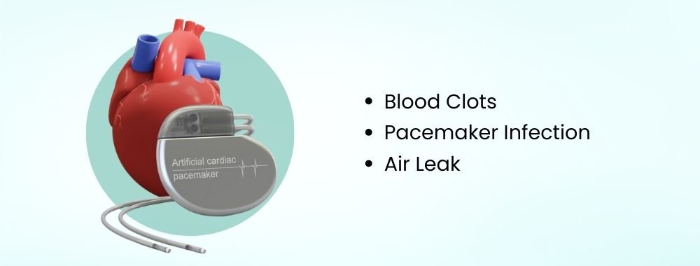 risks and complications management in pacemaker implantation