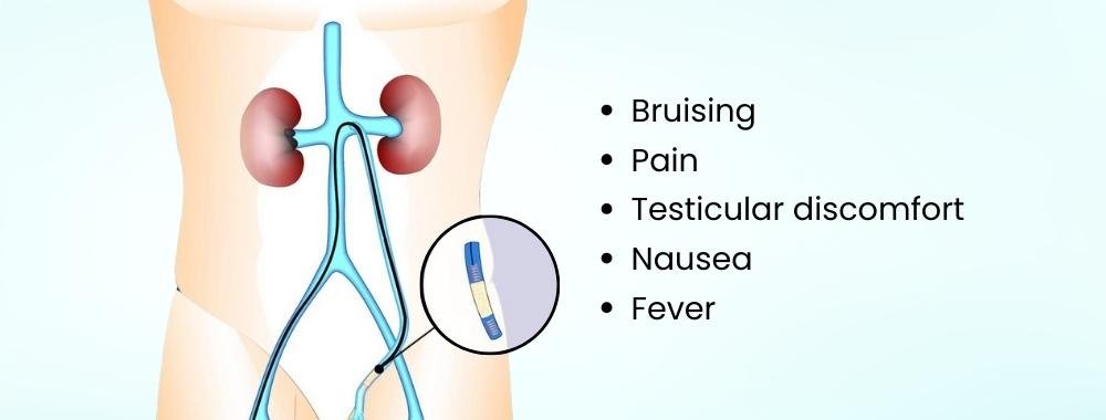 risks and complications management in varicocele embolization