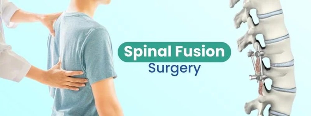 spinal fusion surgery cost in india