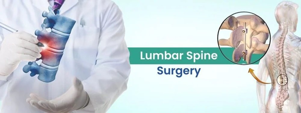 lumbar spine surgery cost in india