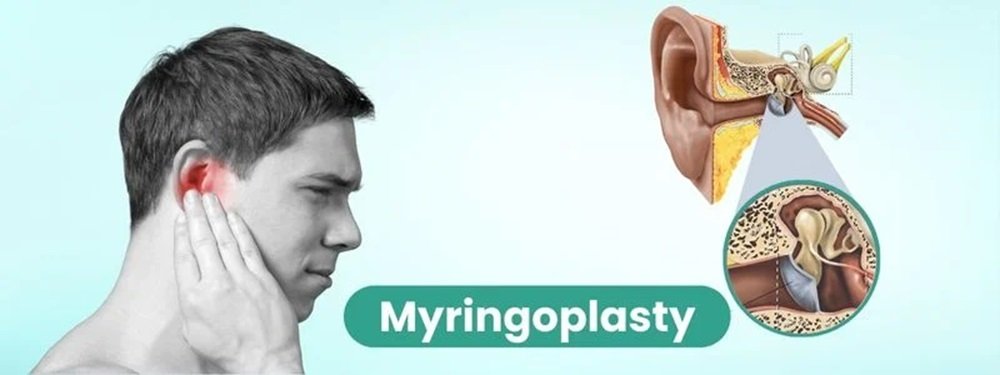 myringoplasty cost in india