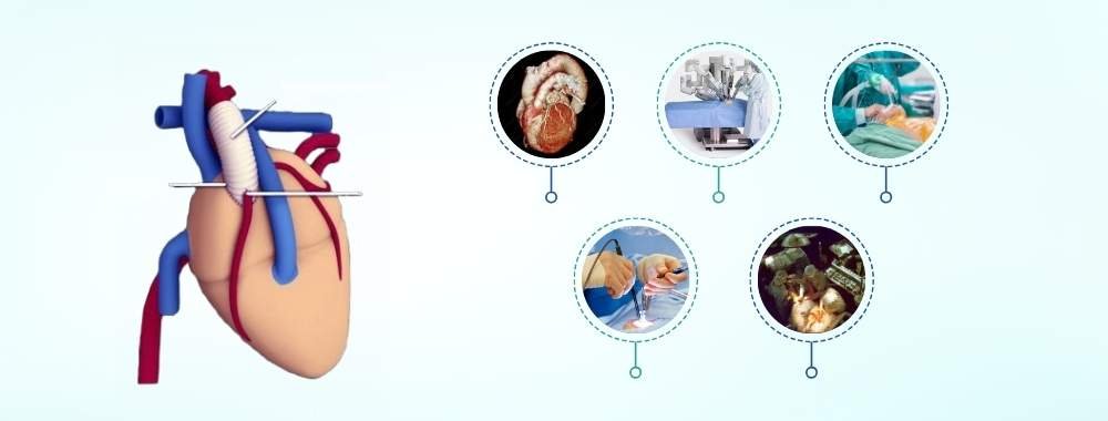 technologies used in india for bentall procedure