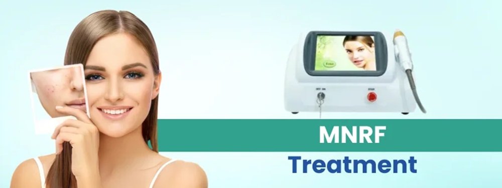 mnrf treatment cost in india