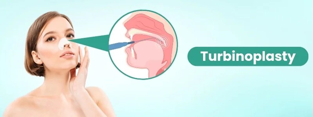 turbinoplasty cost in india