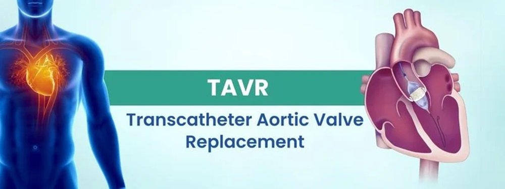 transcatheter aortic valve replacement (tavr) cost in india