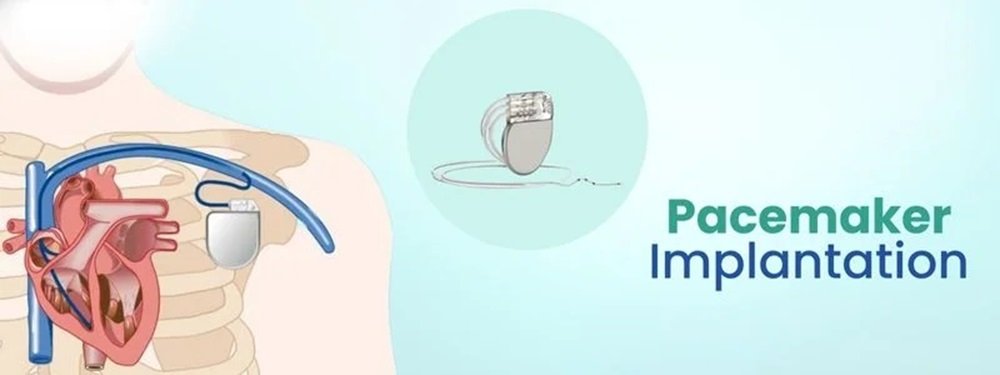 pacemaker implantation cost in india