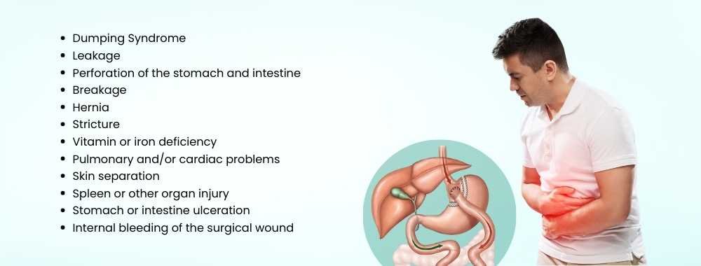 possible complications of gastric bypass surgery